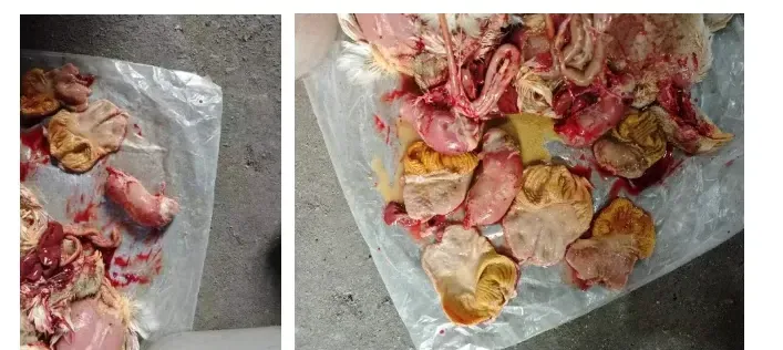 复抗粉加腺胃康成功案例