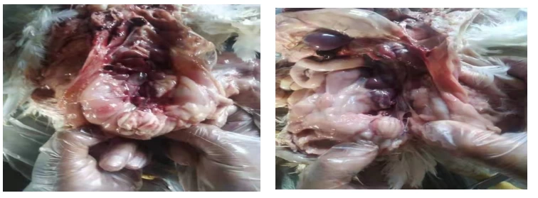 复抗粉加腺胃康成功案例