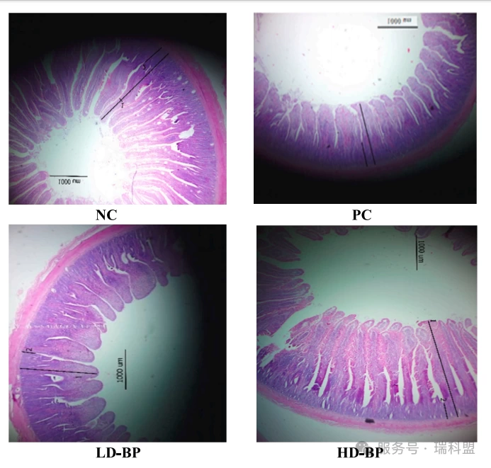 【文献快览】破局“无抗”时代!研究揭示:噬菌体联手益生菌,如何打赢肉鸡肠道健康保卫战